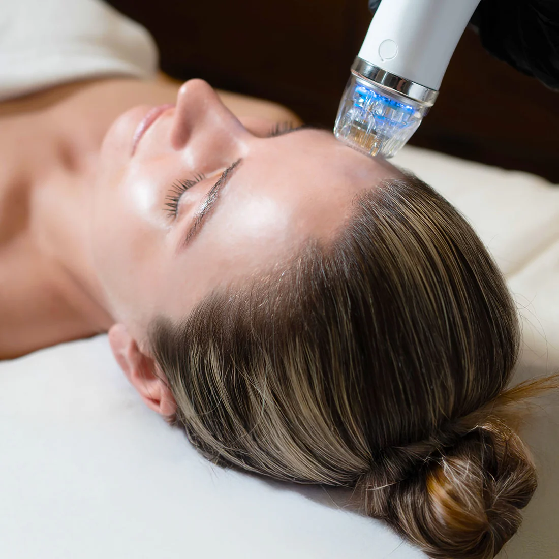 RF Microneedling Treatment